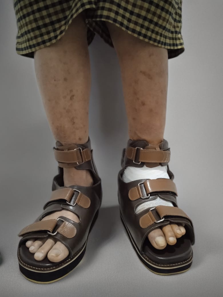 Sandal Diabetic