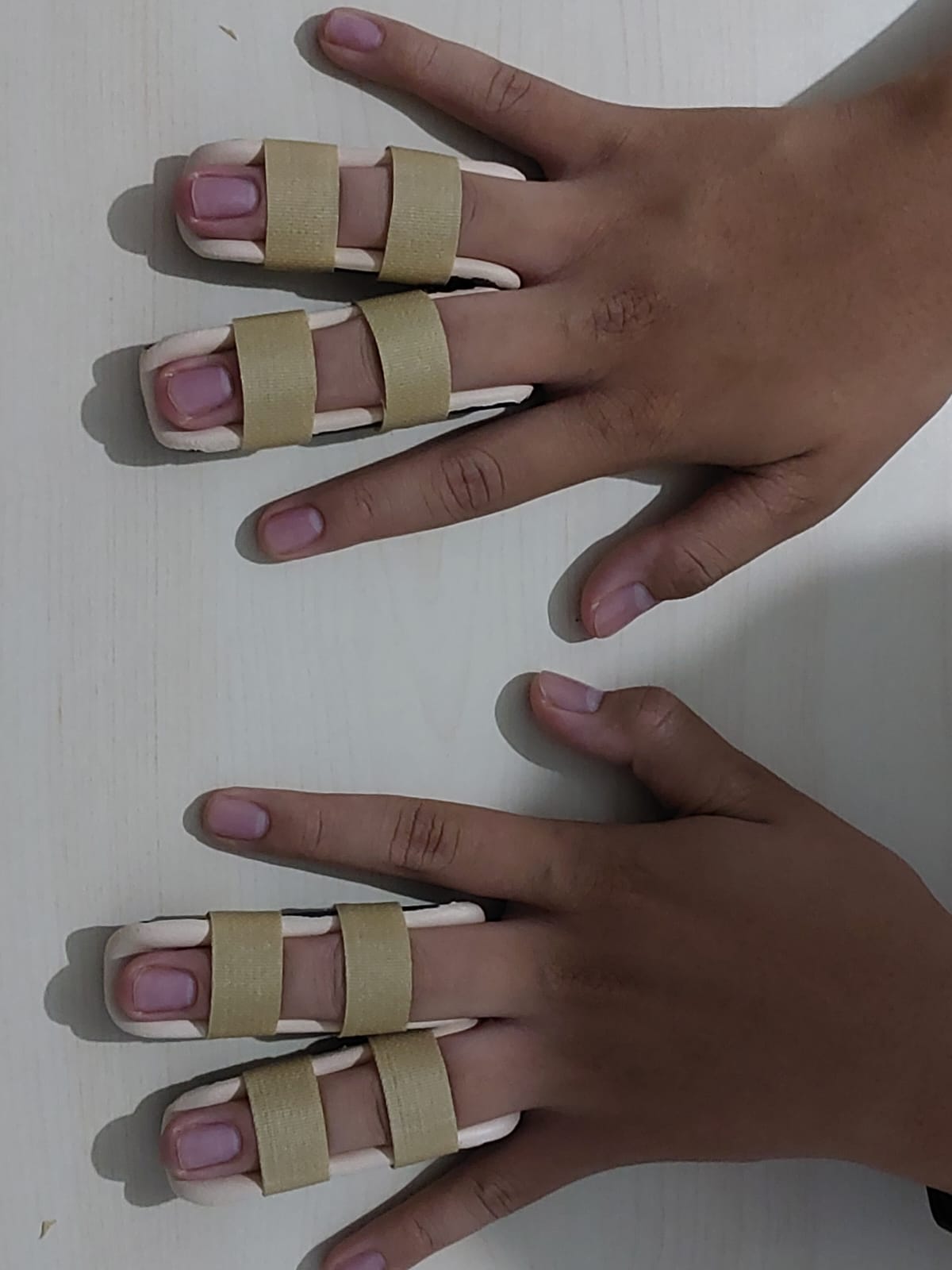 Finger Splint